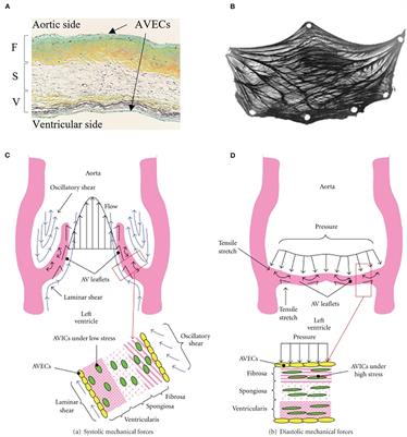 Calcific Aortic Stenosis—A Review on Acquired Mechanisms of the Disease and Treatments